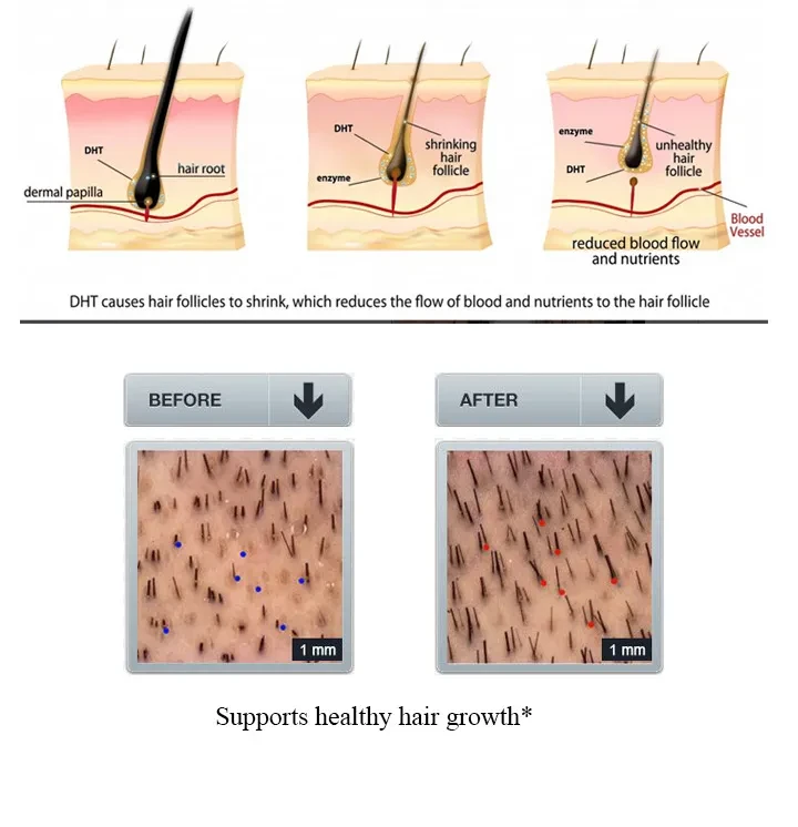 Hair Care Ginger Spray Shampoo Suit